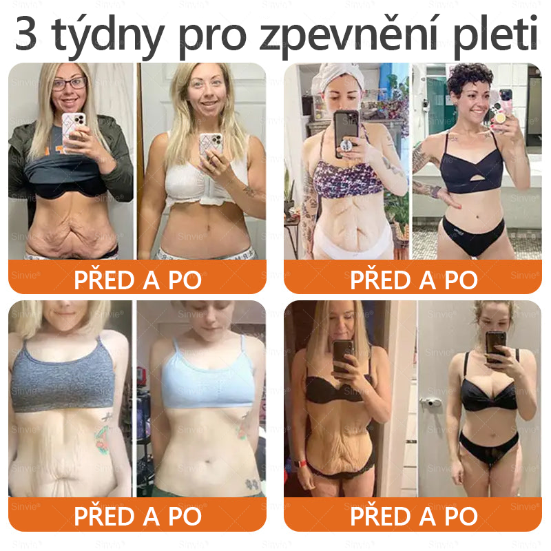 💛💛 Sinvie® Krém na obnovu pleti s včelím jedem ✅CE schváleno 👨‍⚕ Doporučeno dermatology - 50ml