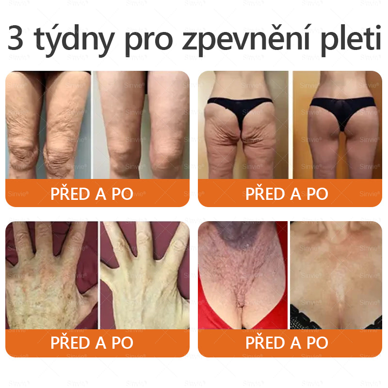 🎁💛🎁 Gratulujeme! Dnes jste mezi šťastnými zákaznicemi – získáváte až 50% slevu! Udržte svou pleť hladkou, pevnou a získejte zpět sebevědomí i krásu!