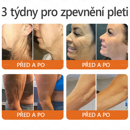 💛💛 Sinvie® Krém na obnovu pleti s včelím jedem ✅CE schváleno 👨‍⚕ Doporučeno dermatology - 50ml