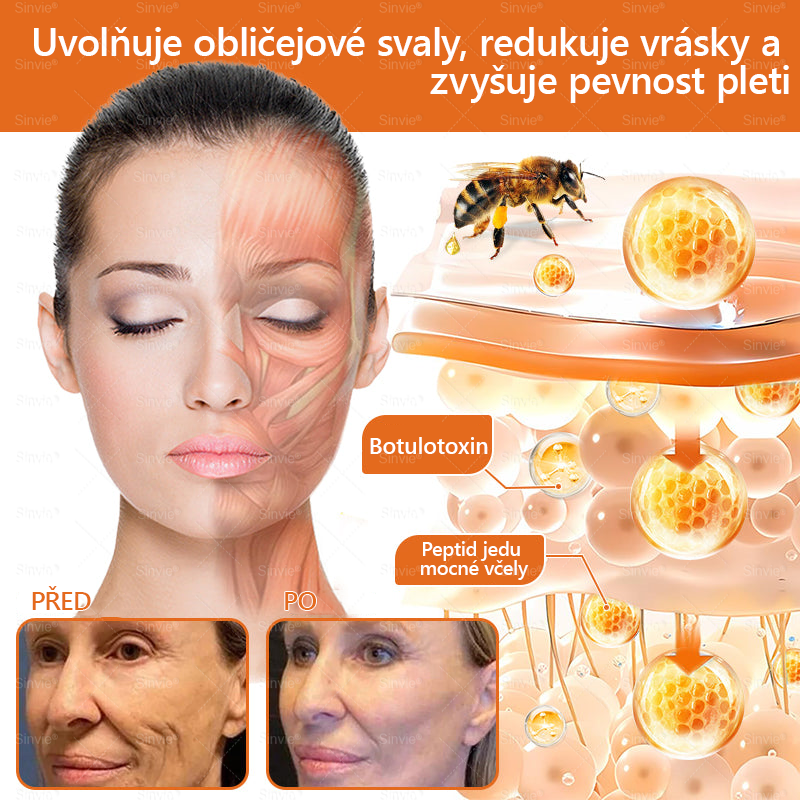 💛💛 Sinvie® Krém na obnovu pleti s včelím jedem ✅CE schváleno 👨‍⚕ Doporučeno dermatology - 50ml