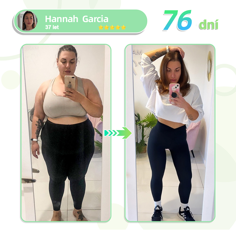 🥑🥑Voilaist® SMGT-GLP-1 Nano Microneedlová Náplast ⏰ (Bezbolestná, dlouhotrvající, zaměřená na řešení cukrovky, obezity a kardiovaskulárních onemocnění)