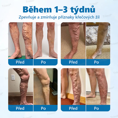💙💙Trimil® VeinGuard Bylinný Sprej — ✅ Klinicky ověřeno, že dokáže zlepšit stav křečových žil už za pouhých 7 dní!