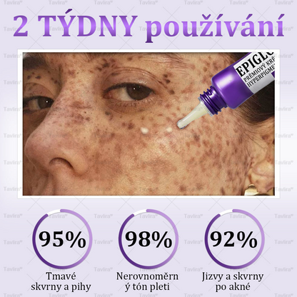 💜💜Tavlira® EPIGLOW MelanEX prémiový krém proti hyperpigmentaci | ✅Schválené zdravotníckym oddelením České republiky