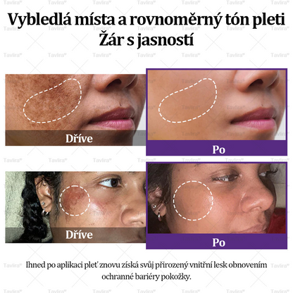💜💜Tavlira® EPIGLOW MelanEX prémiový krém proti hyperpigmentaci | ✅Schválené zdravotníckym oddelením České republiky