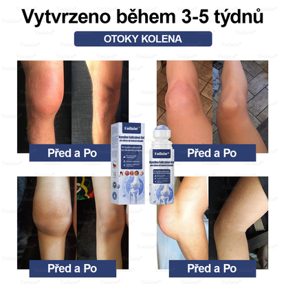 💧Voilaist® Kyselina Salicylová Gel pro úlevu od bolesti kloubů - (snižuje otoky kloubů, bolest, ztuhlost, zarudnutí, teplo, bolestivost a únavu kloubů), obsahuje 4% kyseliny salicylové, glukosamin, MSM, arniku, chondroitin, vitamín K2
