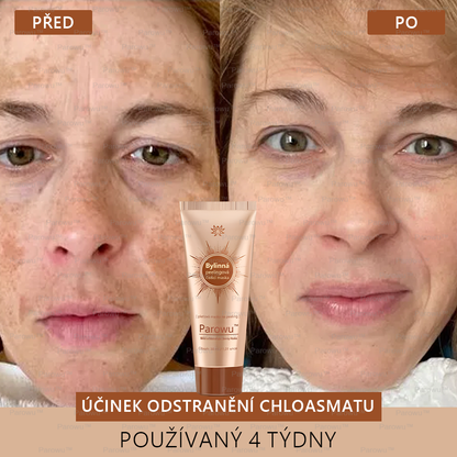 💟💟 Parowu™ Bělící a Odstraňující Skvrny Maska -🍀Přírodní složky trvale odstraňují pigmentové skvrny, stařecké skvrny, pihy a sluneční skvrny
